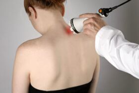 Terapia con láser
